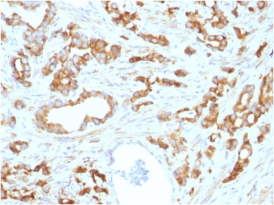 FFPE human prostate sections stained with 100 ul anti-Aurora B (clone AURKB/1593) at 1:50. HIER epitope retrieval prior to staining was performed in 10mM Citrate, pH 6.0.
